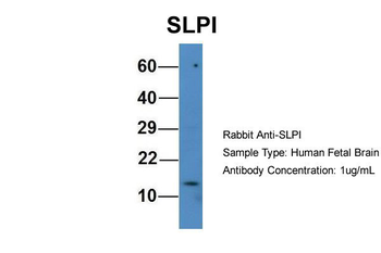 SLPI antibody