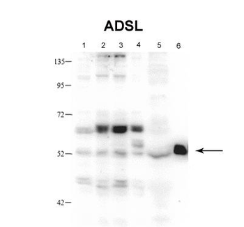 ADSL antibody