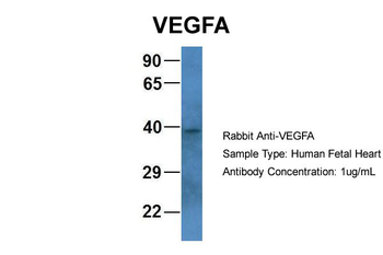 VEGFA antibody