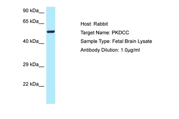 PKDCC antibody