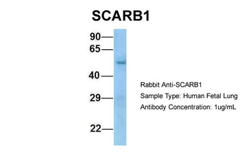 SCARB1 antibody