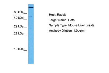 GDF5 antibody