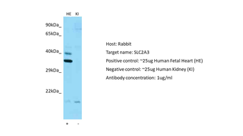 SLC2A3 antibody