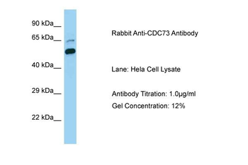 CDC73 antibody