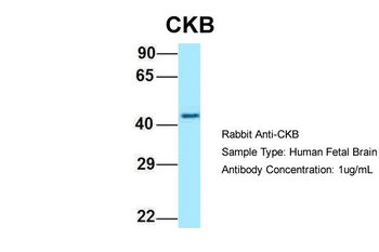 CKB antibody
