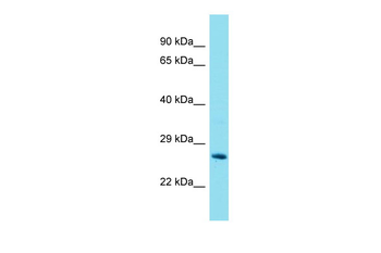 Gstt2 antibody