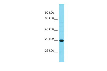 HDHD3 antibody