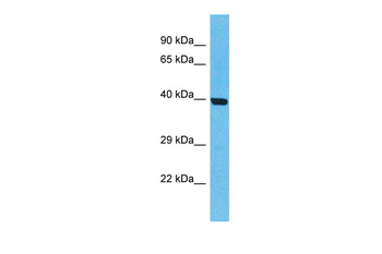 OR5T2 antibody