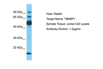 TBKBP1 antibody