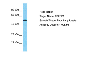 TBKBP1 antibody