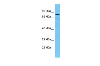 TTC30A antibody