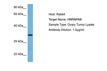 HNRNPAB antibody
