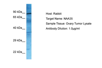 NAA35 antibody