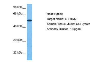 LRRTM2 antibody