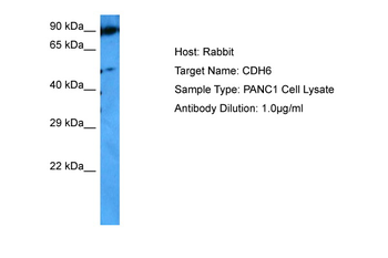 CDH6 antibody