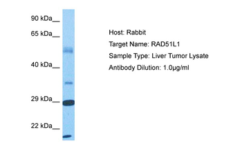RAD51B antibody