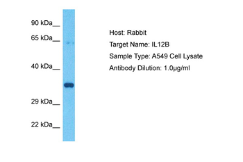 IL12B antibody