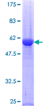 PRDX4 (Human) Recombinant Protein (P01)