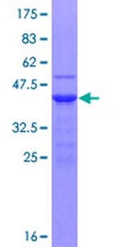 UBE2D1 (Human) Recombinant Protein (P01)