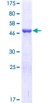 TK1 (Human) Recombinant Protein (P01)