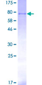 STK11 (Human) Recombinant Protein (P01)