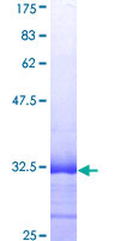 SPINK1 (Human) Recombinant Protein (Q01)