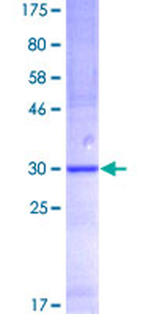 SPINK1 (Human) Recombinant Protein (P01)