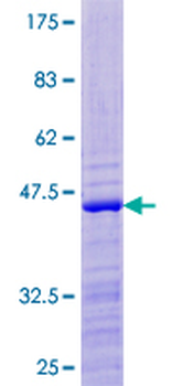 RPS24 (Human) Recombinant Protein (P01)