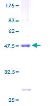 RPS10 (Human) Recombinant Protein (P01)