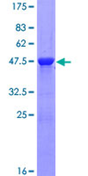 MYL1 (Human) Recombinant Protein (P01)