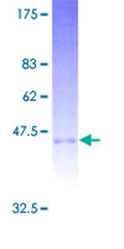 KLRD1 (Human) Recombinant Protein (P01)