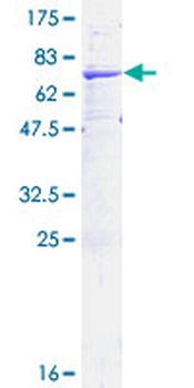 HSD11B2 (Human) Recombinant Protein (P01)