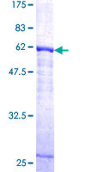 CTSK (Human) Recombinant Protein (P01)