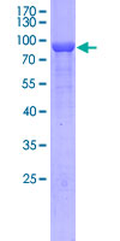 CRMP1 (Human) Recombinant Protein (P01)