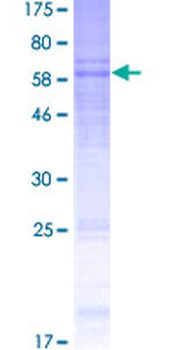 CRHR1 (Human) Recombinant Protein (P01)