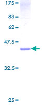 CENPA (Human) Recombinant Protein (P01)