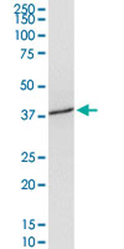 SLC39A3 purified MaxPab mouse polyclonal antibody (B01P)