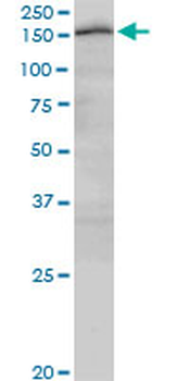 CUX2 monoclonal antibody (M03), clone 2H8