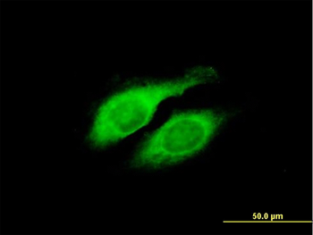 LYPLA2 purified MaxPab mouse polyclonal antibody (B01P)