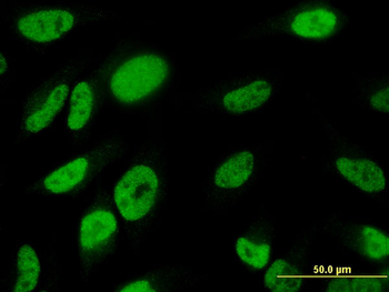 TBX18 monoclonal antibody (M06), clone 4D3