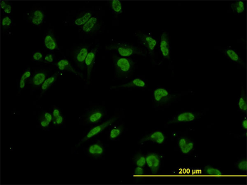 TRIM24 monoclonal antibody (M01), clone 2F2