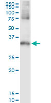 STK16 MaxPab rabbit polyclonal antibody (D01)