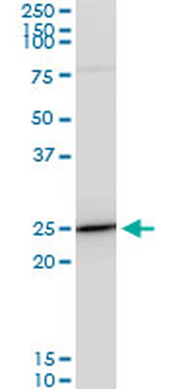 TPT1 monoclonal antibody (M06), clone 2A3