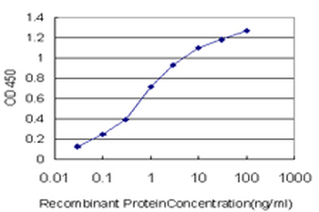 GLUL monoclonal antibody (M02), clone 3B6