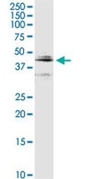 CTSD purified MaxPab rabbit polyclonal antibody (D01P)