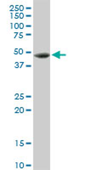 CTSD MaxPab rabbit polyclonal antibody (D01)