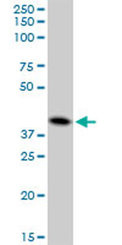 CTSD purified MaxPab mouse polyclonal antibody (B01P)