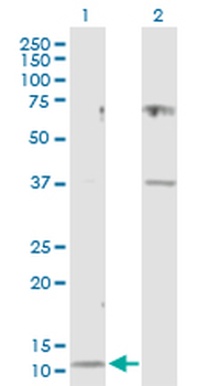 CST3 purified MaxPab rabbit polyclonal antibody (D01P)