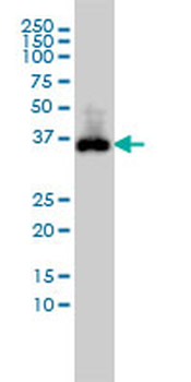 CDX2 monoclonal antibody (M01), clone 1C7