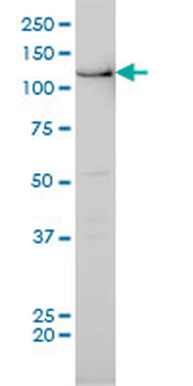 BUB1 monoclonal antibody (M02), clone 2F9